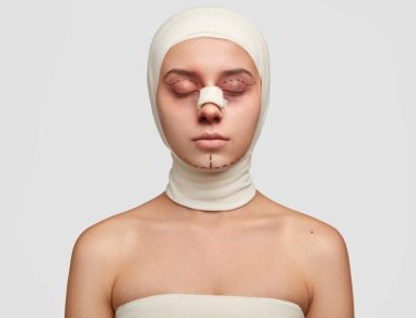 Photo of young female has contour plastic, gets ready for cosmetic surgery, has doted lines on eyelids and chin, bruises near eyes, wrapped in medical bandages, isolated over white background