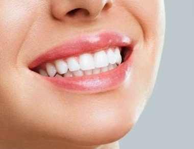 Lente de contato dental: Saiba as vantagens e desvantagens do procedimento