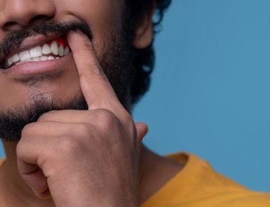 Cropped photo of a bearded mustached guy demonstrating his white teeth and red inflamed gums